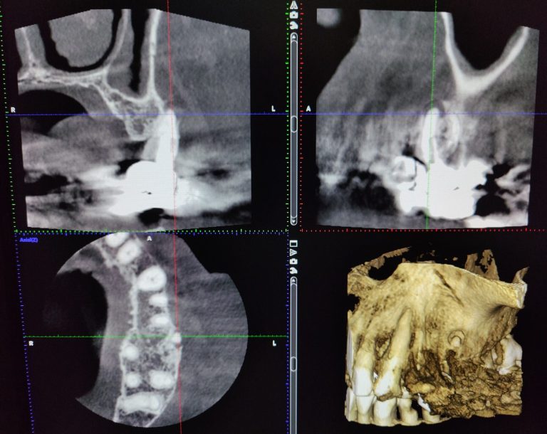 3D Diagnostik